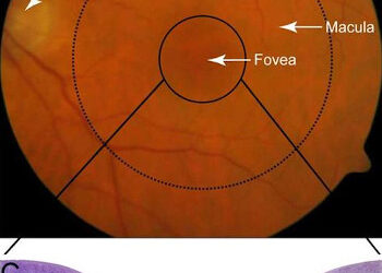 DMAE seca (I): mecanismos, objetivos terapéuticos