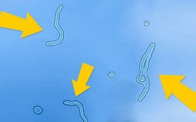 Centelleos, manchas flotantes y desprendimiento de la retina