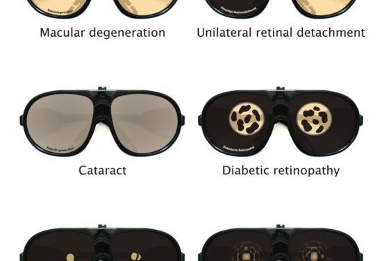 Cómo ve un paciente con afectación visual