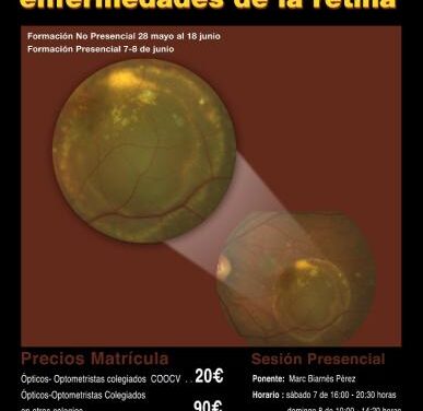 Lo que necesita saber el óptico-optometrista sobre enfermedades de la retina