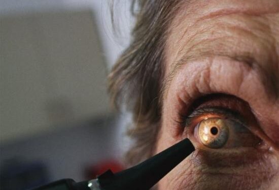 Identifican siete regiones genéticas asociadas con la DMAE