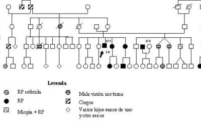 Diagnóstico y tratamiento de síndrome de Usher
