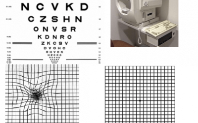Semana de sensibilización sobre la DMAE