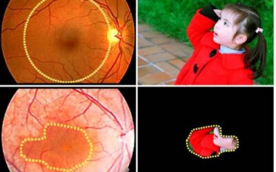 Células madre específicas del paciente y terapia genética personalizada