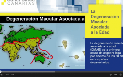 La Degeneración Macular Asociada a la Edad: Servicio Canario de Salud