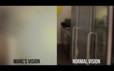¿Sabes cómo es quedarse casi ciego? Mira este vídeo