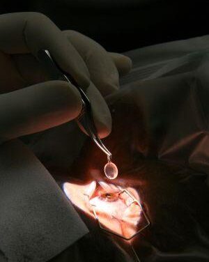 Primer tratamiento ocular con células madre de la UE
