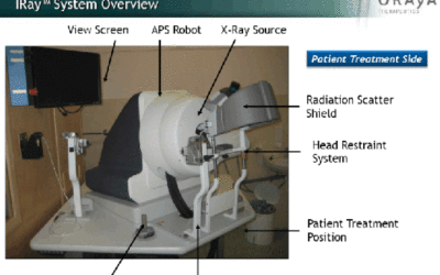 Una solución de radioterapia para la DMAE