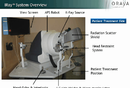 Una solución de radioterapia para la DMAE