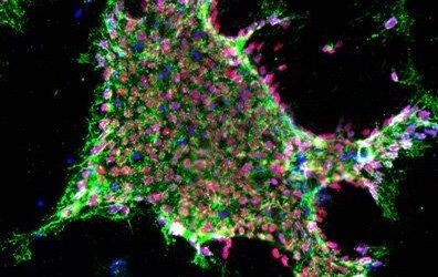 Células madre que ralentizan la pérdida de visión