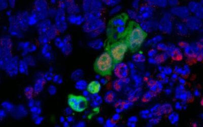 Un nuevo tipo de célula madre abre una nueva vía para crear órganos