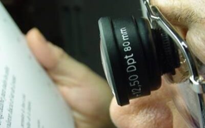 Consejos prácticos sobre DMAE (por Centro Óptico Alomar)