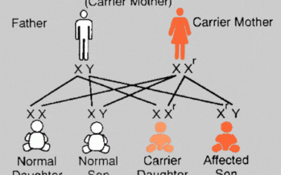 Retinosis Pigmentaria ligada al cromosoma X