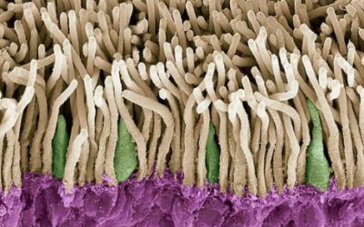 Soraprazan terapia regenerativa para Stargardt y DMAE