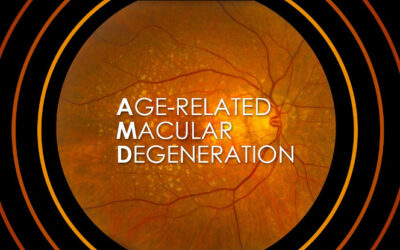Éxito fase 2 ensayo APL-2 para DMAE