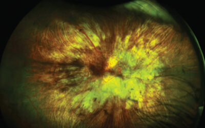 Conferencia Internacional sobre CHM 2018