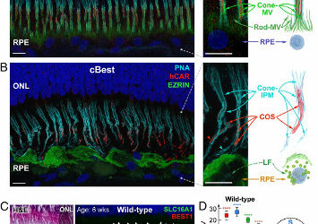 Ensayos de terapia génica para enfermedad de Best