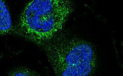 Estudio para CEP290 en Leber 10