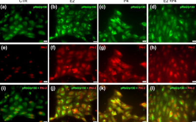 Hormonas esteroides y DMAE