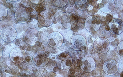 Implante de retina CPCB-RPE1 y DMAE