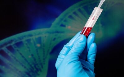 Zimura combinado con terapia anti-VEGF para DMAE