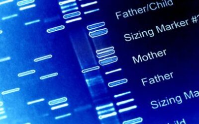 Identifican 161 factores genéticos de la miopía
