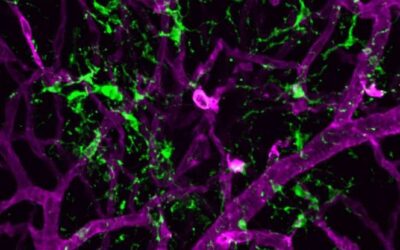 Microglía, visión y desprendimiento de retina