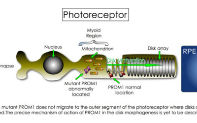 ProgStar el mayor estudio de historia natural para Stargardt
