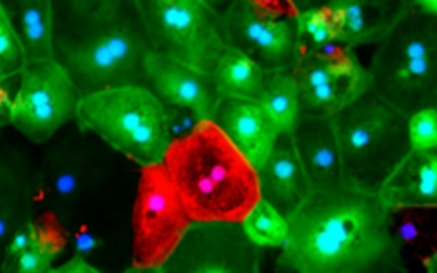Terapia génica HMR59 para atrofia geográfica