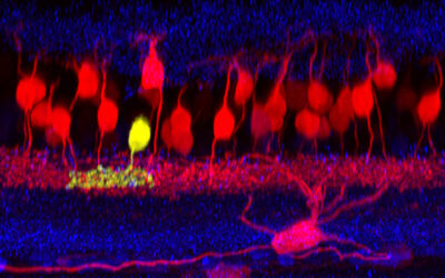 Cómo las células retinianas responden a la diabetes