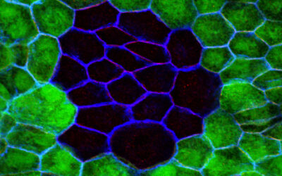 Investigación sobre DMAE: Cultivo de epitelio pigmentario de la retina