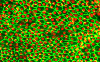 Células madre para la DMAE húmeda