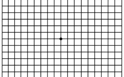 Diez preguntas a su médico sobre DMAE