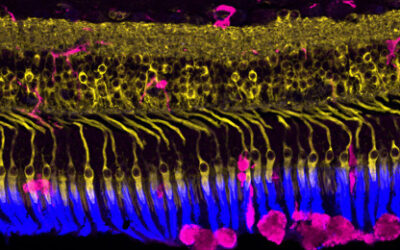Rejuvenecimiento de la retina con Ellex 2RT