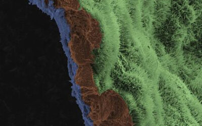 Parche de epitelio pigmentario de la retina en ratones y cerdos