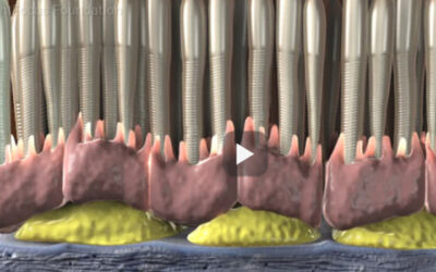 ¿Por qué mi médico está siempre hablando de «drusas»?