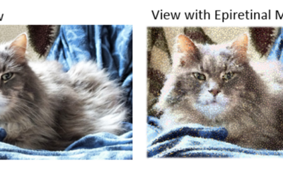 Membrana epirretiniana macular