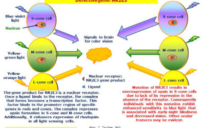 Síndrome de Goldmann-Favre
