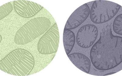 Primer paciente tratado con Elamipretide de Stealth BioTherapeutics para DMAE con atrofia geográfica