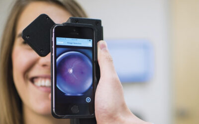 Detección precoz de retinopatía diabética con inteligencia artificial en teléfonos inteligentes