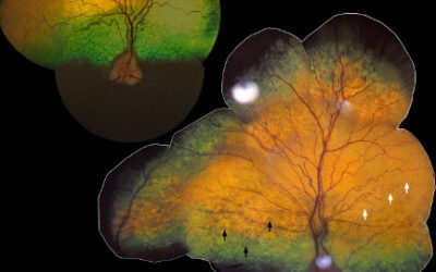 Nuevo modelo animal para la enfermedad de Stargardt