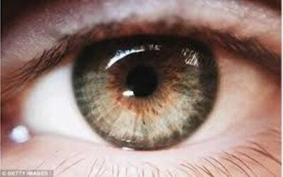 Retinosis pigmentaria 20