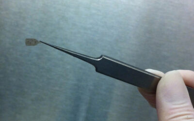 Regalo para los ojos: parches de células madre para la DMAE húmeda y seca