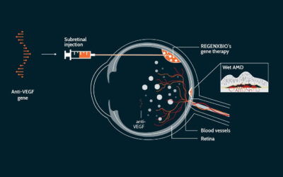 Ensayos de terapia génica para DMAE húmeda