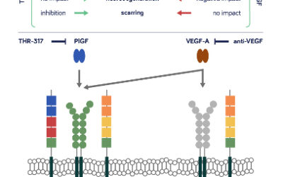Estudio THR-317 para edema macular diabético