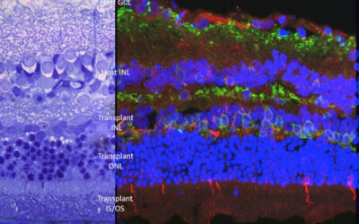 Trasplante de fotorreceptores y degeneración de retina