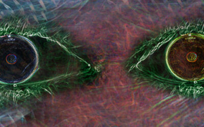 Iveric Bio avanza en terapia minigénica para Amaurosis LCA10