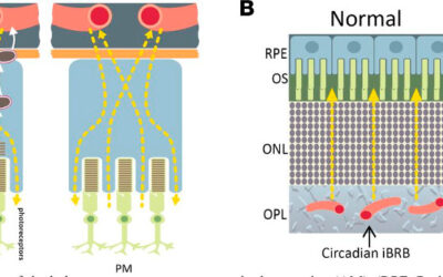 Importante descubrimiento para comprender la DMAE seca