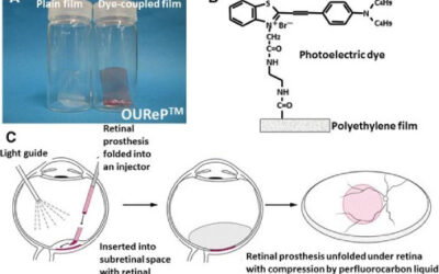 Prótesis para la estimulación retiniana