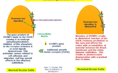 Distrofia retiniana en panal de Doyne